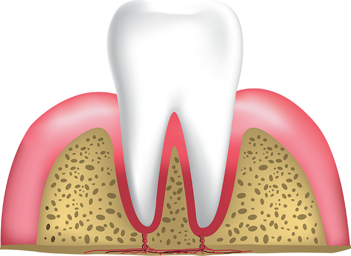 healthy gums and tooth Lafayette IN