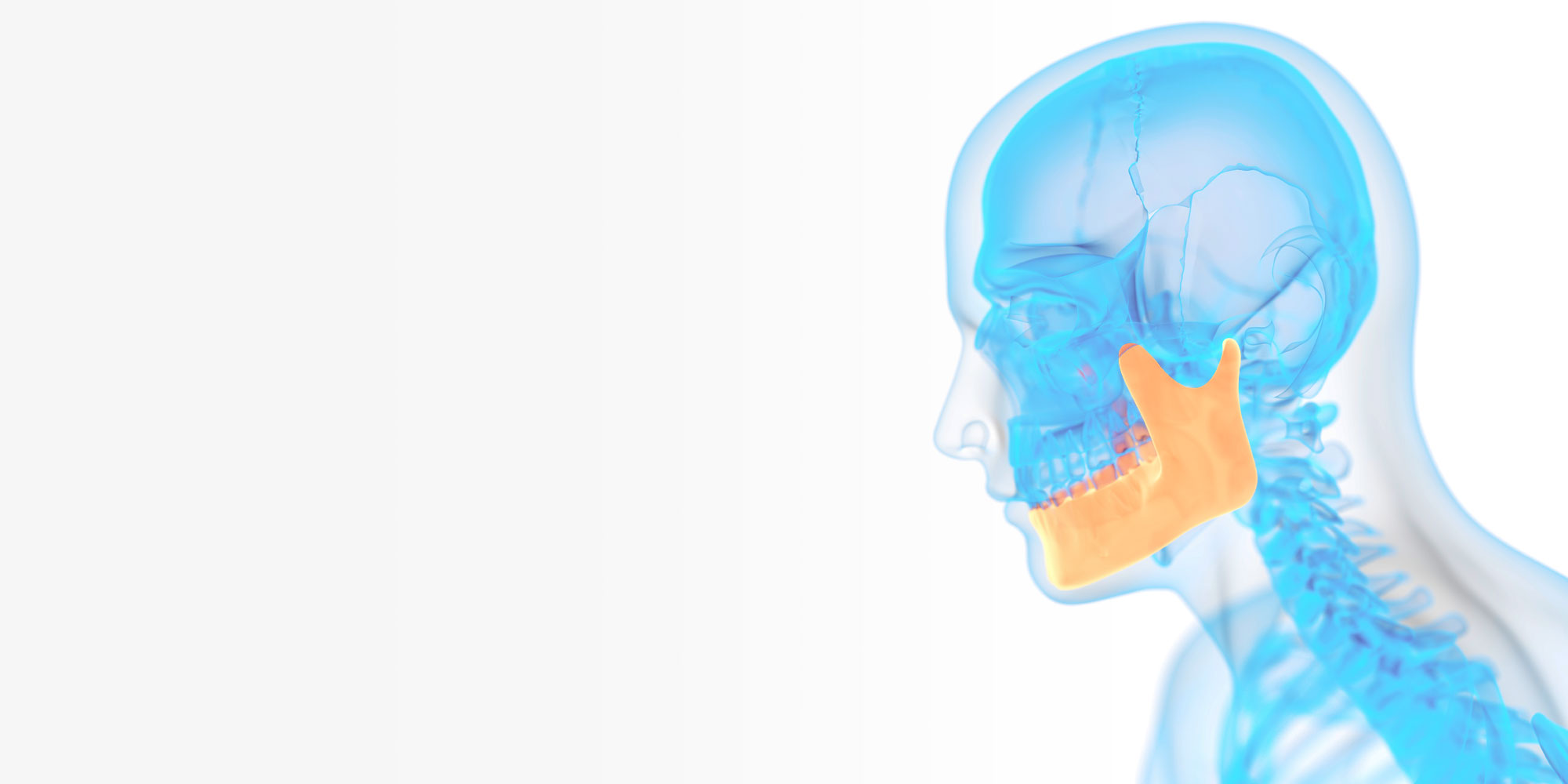 jaw bone xray Lafayette IN